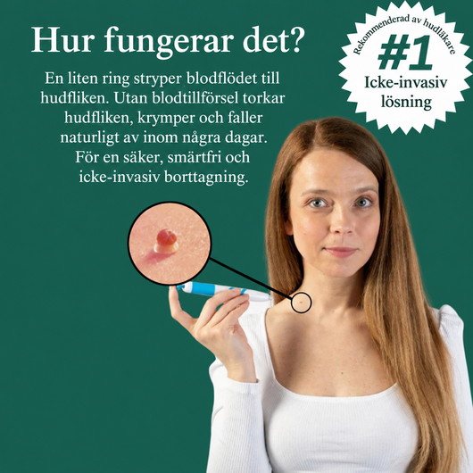 Hudfliken torkar in och faller av. Utan att du bokar en enda tid.